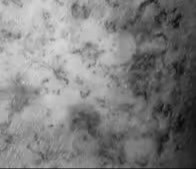 Depiction of radiation effects on tissue.